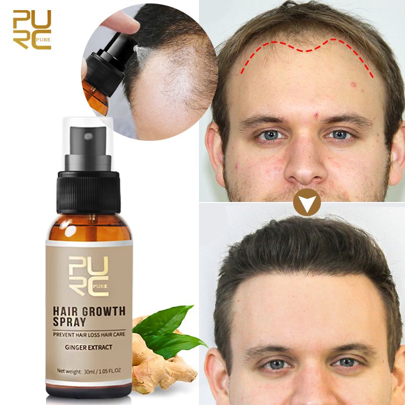 Licorice Root Sticks - PURC Gember Haargroei Spray Anti Haaruitval